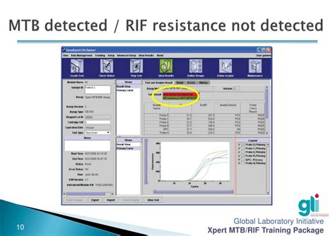 what if mtb is not detected|The New Xpert MTB/RIF Ultra: Improving Detection of.